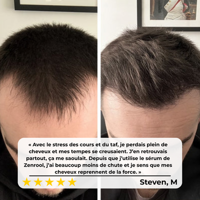 Protocole Anti-Chute & Pousse Des Cheveux