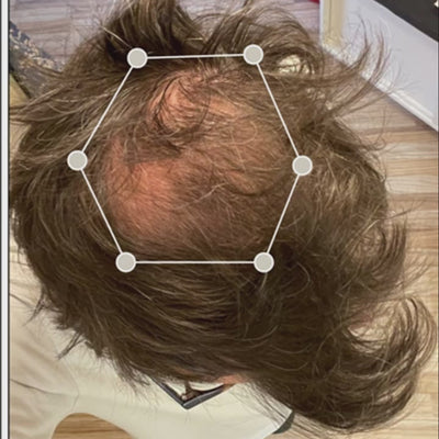 Protocole Anti-Chute & Pousse Des Cheveux